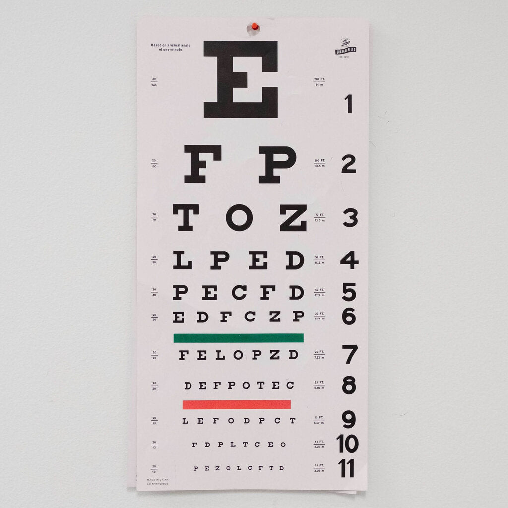 eye-test-exam-screening-in-singapore-eye-check-up-eyecare-people